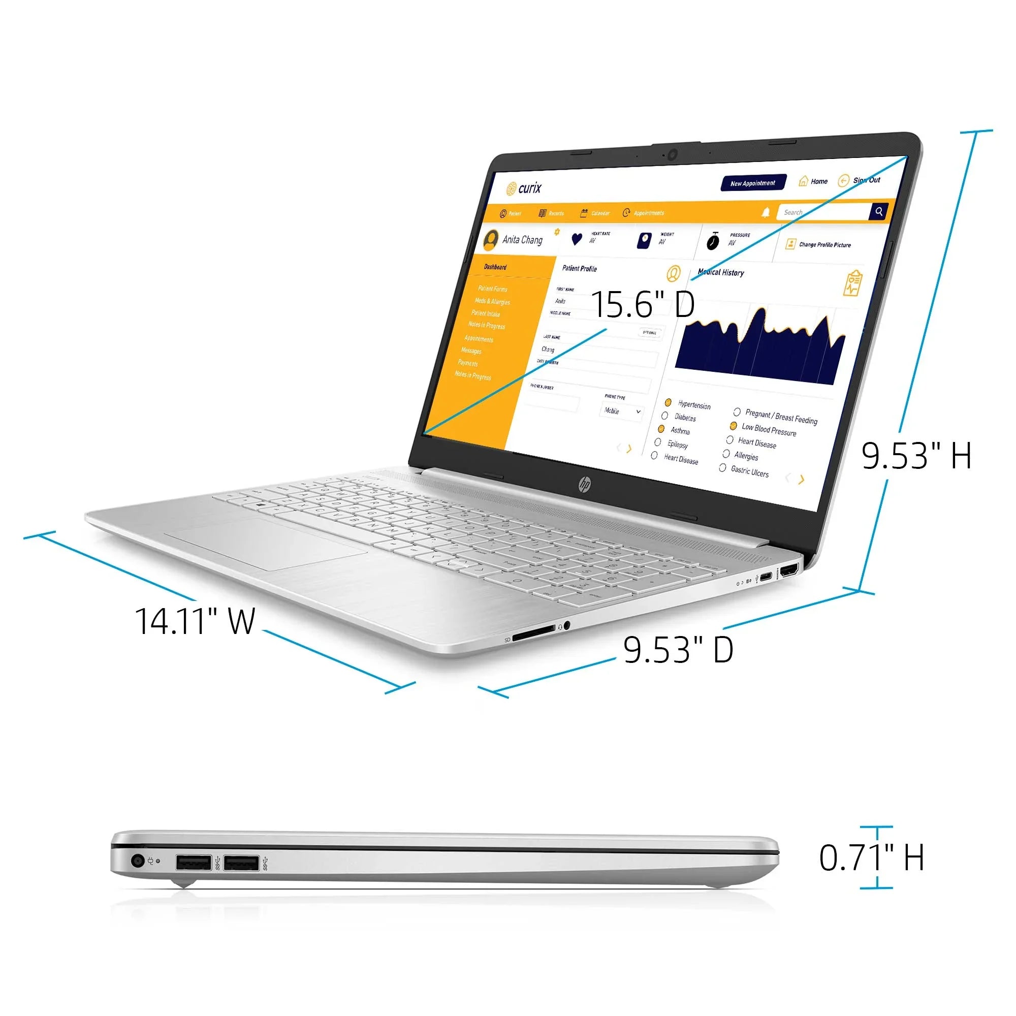 HP 15.6" i3 8GB/512GB Laptop-Sizeilver